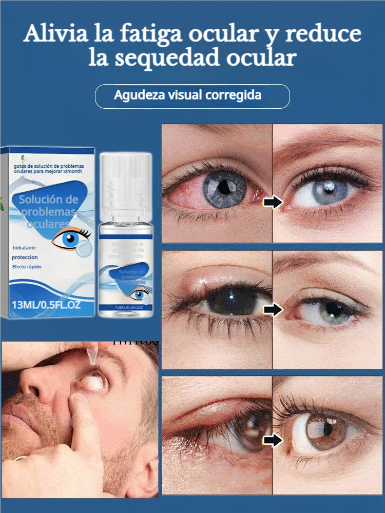 Gotas para los ojos regėjimui ištaisyti.