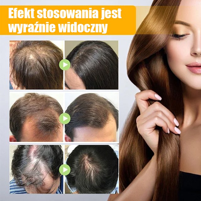 Biotino aerozoliai matu augšanii 
