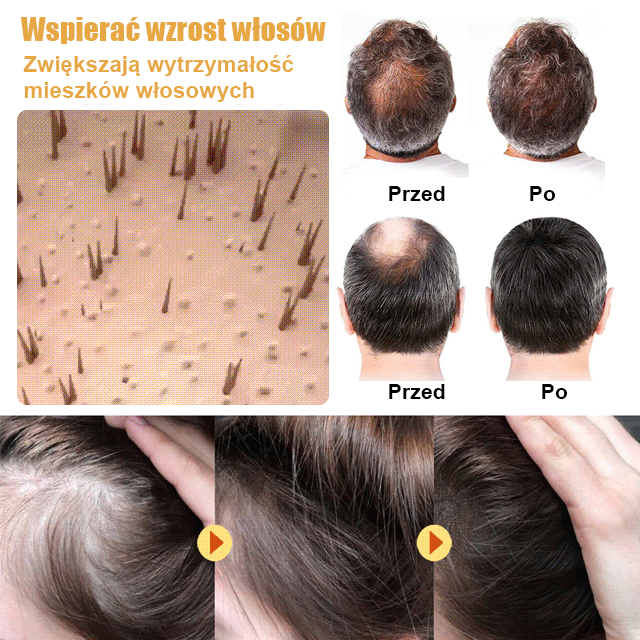 Biotiinisprei plaukų augimas 