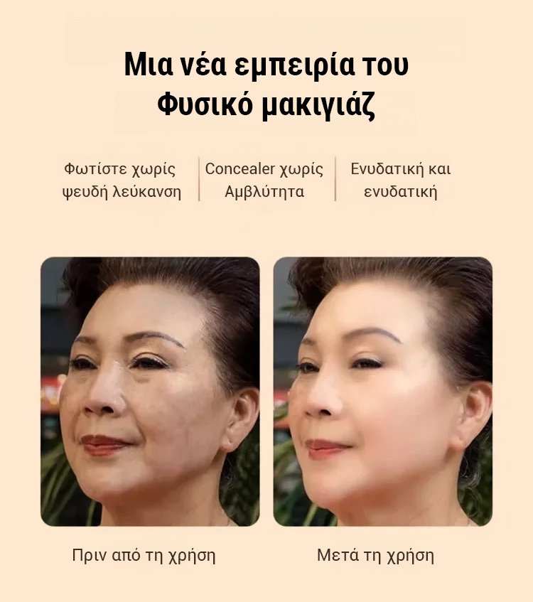 Κρέμα προσώσεις νιασιναμίδης για aristokratikés kyrygues-GR 