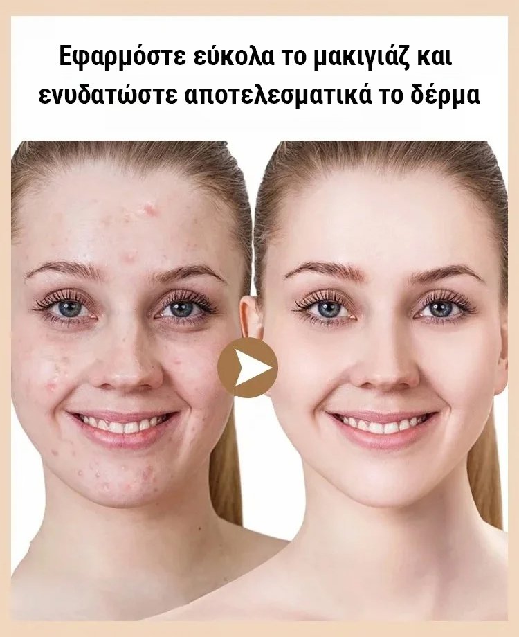 Κρέμα προσώσεις νιασιναμίδης για aristokratikés kyrygues-GR 