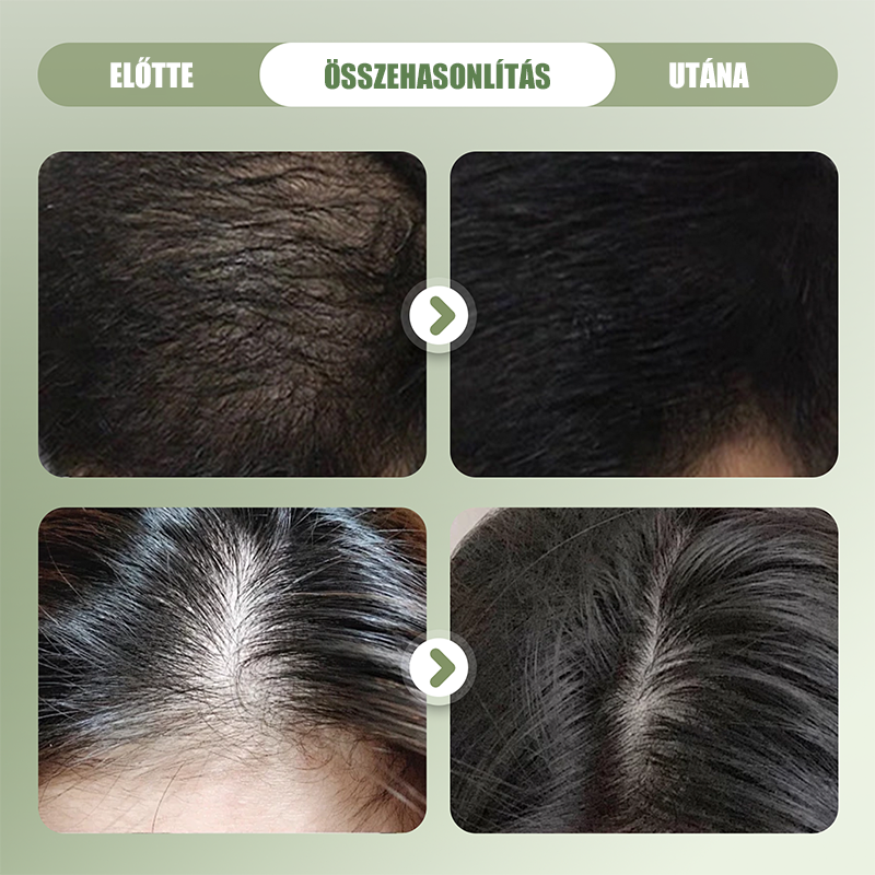 🌿 Naravni trd šampon za krepitev las 🌱🥰--SI