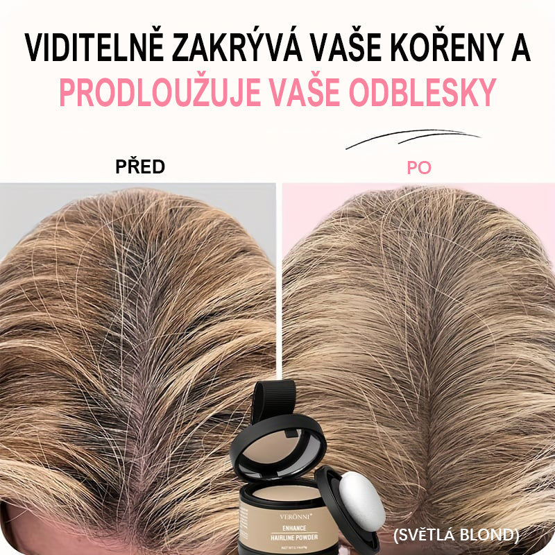 🎉 Ο θύλακας της τρίχας κρύβει αμέσως την τριχόπτωση-GR