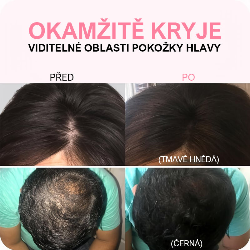 🎉Plaukų linjos pudra akimirksniu paslepia plaukų slinkimā-LT