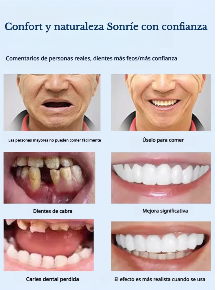 Simulación de blanqueamiento de protesis ajustables μέσω snap-on 