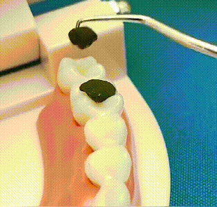 🦷Nerūdijančio plieno dantų krapštukų rinkinys-LT