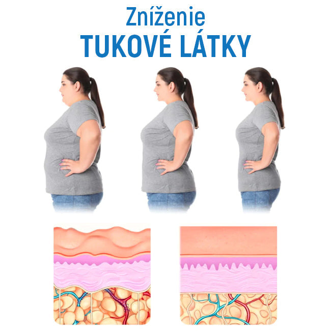 ✨Kupite eno in dobite brezplačno✨ spodnje perilo za oblikovanje telesa